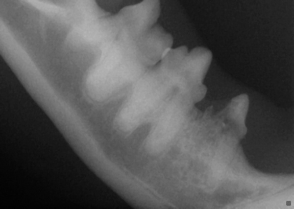 X-ray showing destruction of lower premolar affected by tooth resorption