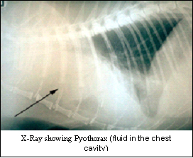 pyothorax-1