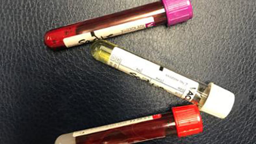 876x493 encina wellness testing