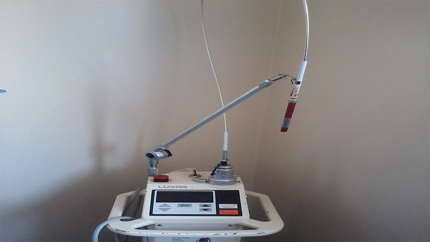 876x493 lakes region LaserSurgery