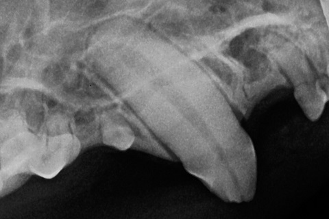 2_x-ray_showing_root_canal_exposure