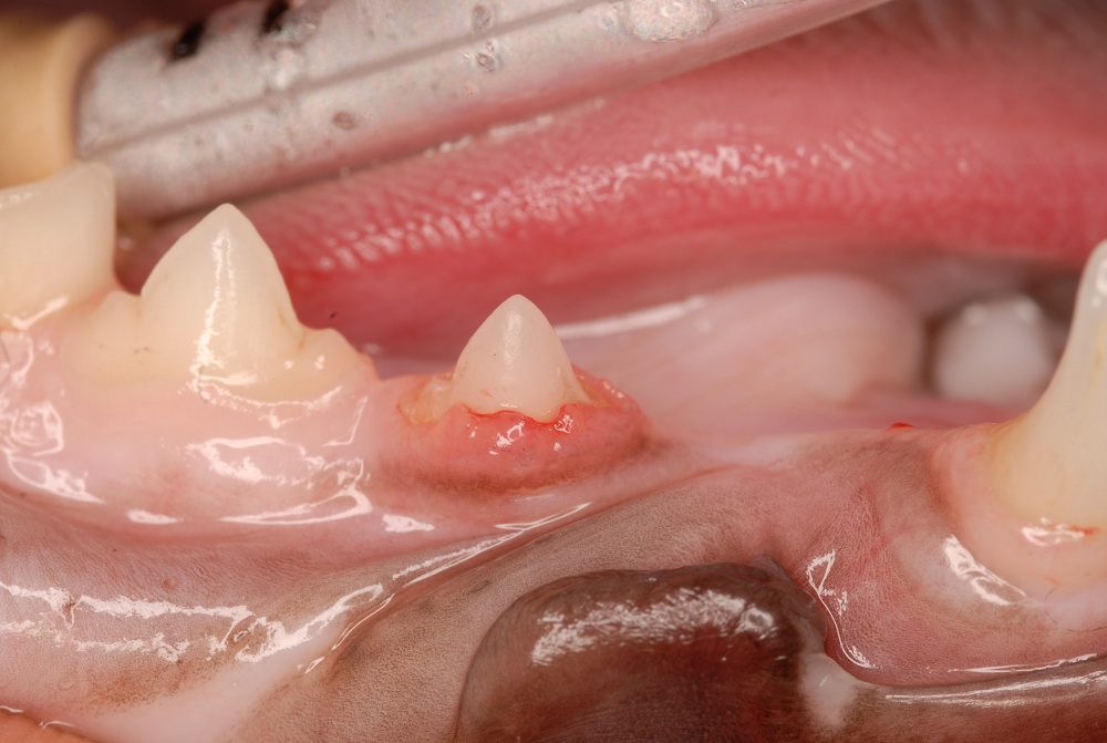 Lower premolar resorbing tooth