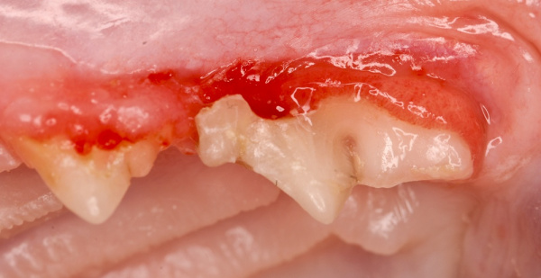 Upper fourth premolar resorption