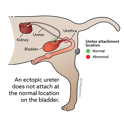 Identification of normal versus abnormal ureter