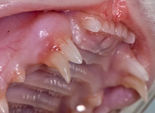Retained deciduous upper canine teeth