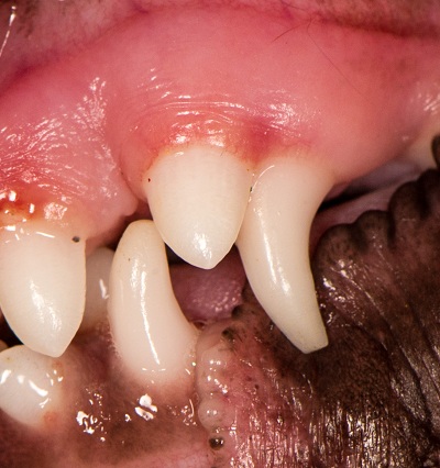 Retained upper canine causing abnormal stretching of the surrounding gum line