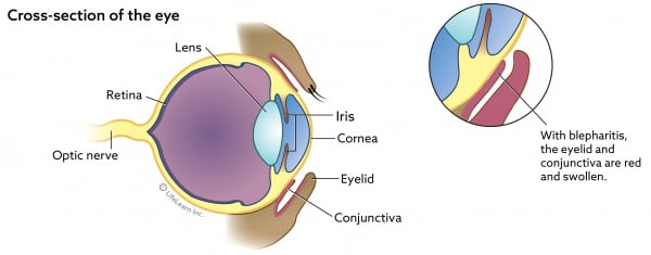 is blepharitis contagious in dogs