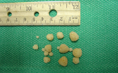 can dogs pass bladder stones