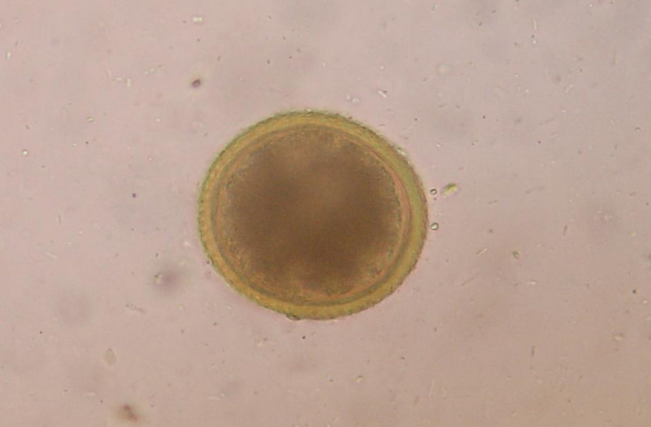 toxocara_canis_roundworm_egg_2