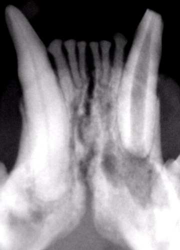 Abscessed root of a lower canine tooth