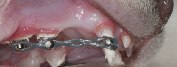 Orthodontic buttons and elastics used to move the malpositioned canine caudally