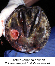 puncture_wounds_of_the_foot-1