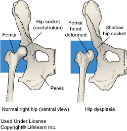 Dog leg dislocation symptoms