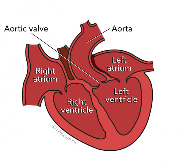 Aortic Stenosis In Dogs Vca Animal Hospital