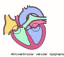 Atrioventricular Valve Dysplasia in Cats | VCA Animal Hospital