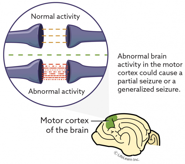 Seizures And Syncope Vca Animal Hospital