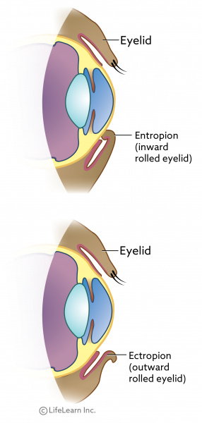 pigmentary keratitis eye drops