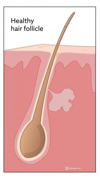 dog acne plastic bowls