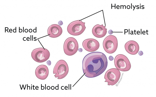 Blood Transfusion Reactions in Dogs | VCA Animal Hospital