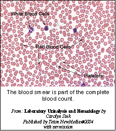 Coombs Test Vca Animal Hospital