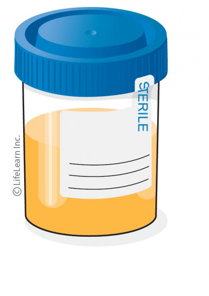 how-to-detect-protein-in-urine-rowwhole3