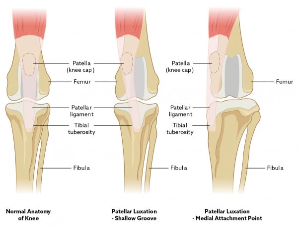 kneecap subluxation recovery