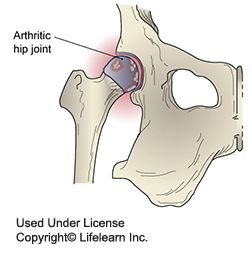 Arthritis In Dogs Vca Animal Hospital