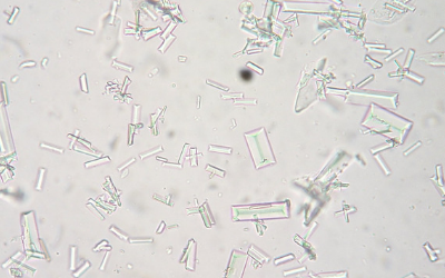 struvite crystals in puppy urine