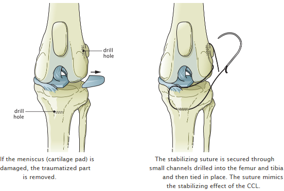 Cranial Cruciate Ligament Repair Extracapsular Repair And Tightrope