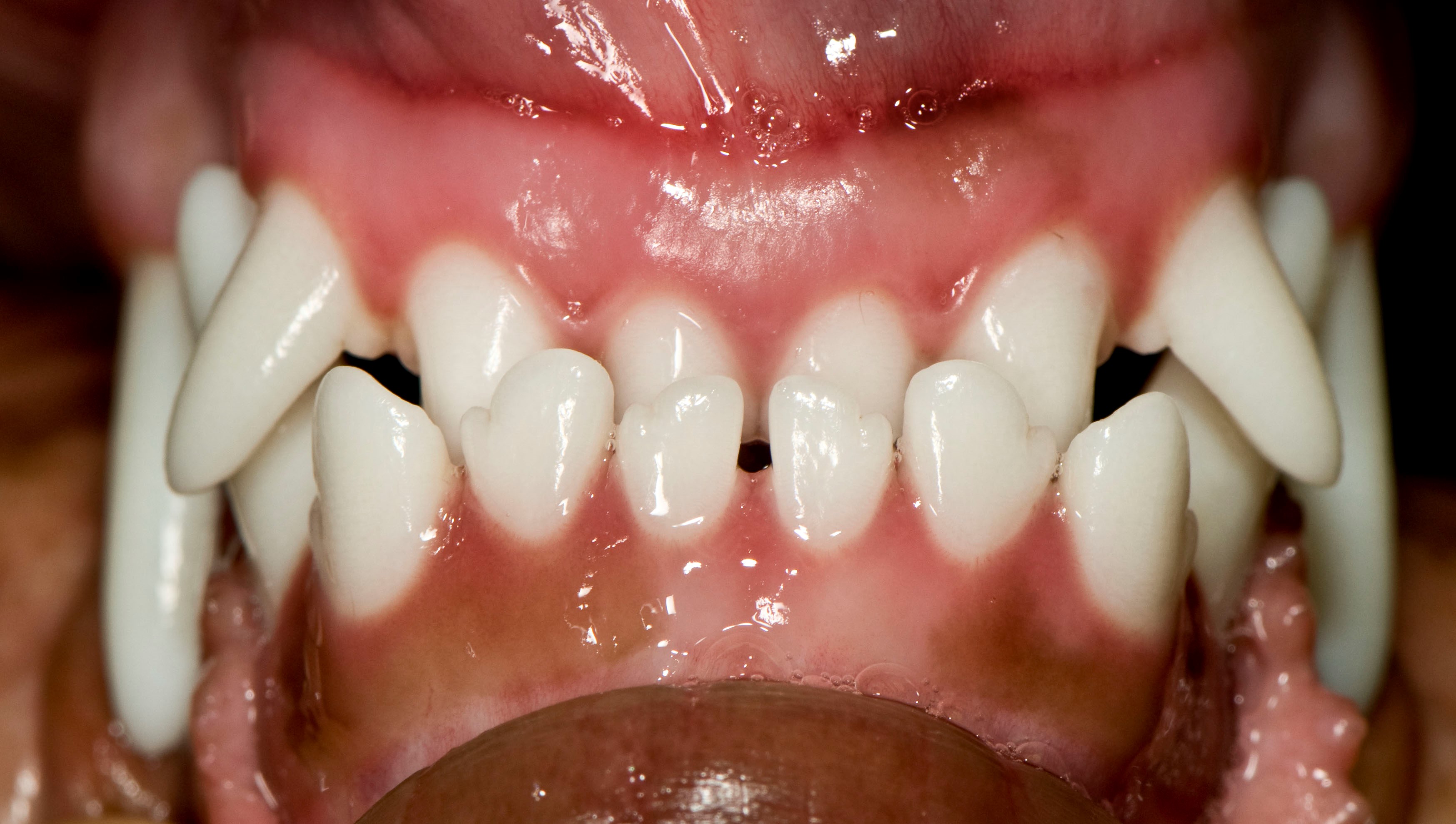 Malocclusions in Dogs When Teeth Don't Align VCA Animal Hospital