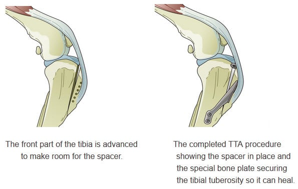 Cranial Cruciate Ligament Repair Tibial Plateau Leveling
