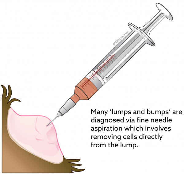 examinaiton and anal syringe needle Deep