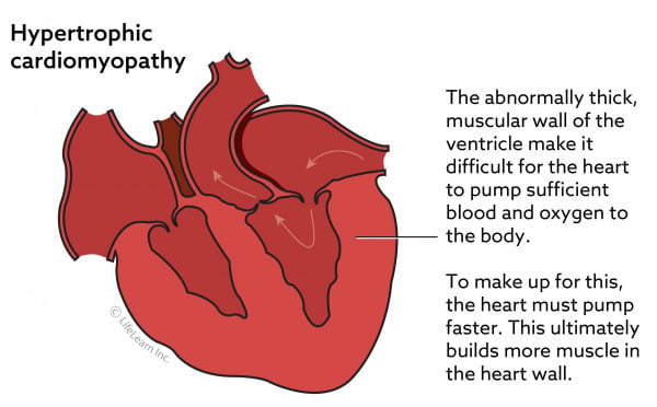 cardiomyopathy-in-cats-vca-animal-hospital