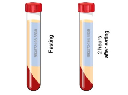 Bile Acid Test | VCA Animal Hospital