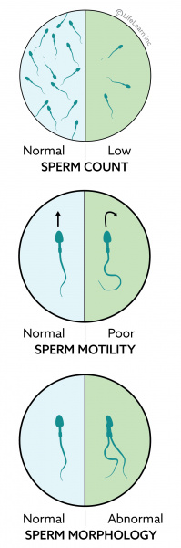 infertility sperm dogs male semen cats abnormalities cat poor vca animal pet hospital number low vcahospitals defects