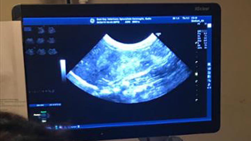 876x493 encina ultrasound